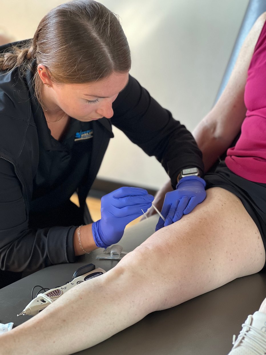 dry needling
